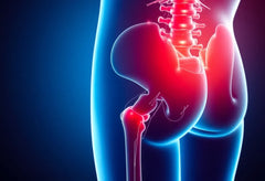 Schmerzfrei leben: effektive wege zur therapie von ischiasschmerzen