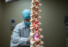 Versteifungsoperation an der wirbelsäule: was Sie wissen müssen, bevor Sie sich entscheiden