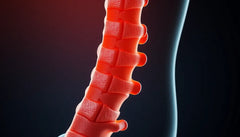 Schmerzfrei leben mit den richtigen spondylose medikamenten